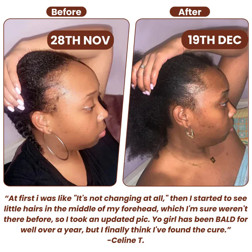 Grows Pure Batana Oil