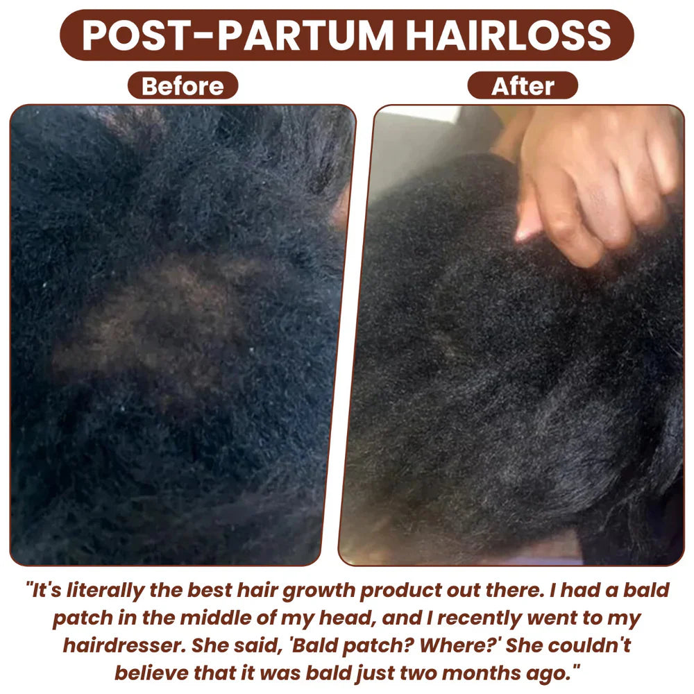 Grows Pure Batana Oil